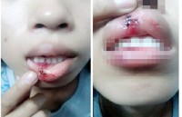 Xác minh clip ‘dập môi vì đòi CSGT giải thích’