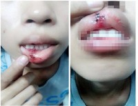 Công an Đồng Nai làm việc với nạn nhân vụ clip bị đánh dập môi
