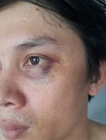 Phóng viên tố bị đánh khi tác nghiệp