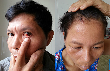 Xô xát, bị dân phòng đánh...